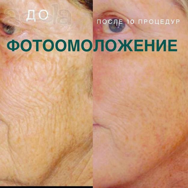 Услуги косметолога в Коломне