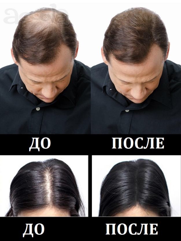 Загуститель для волос