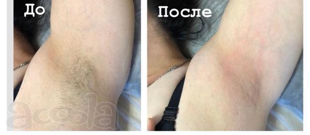 Мастер по шугарингу