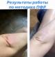 Психо-функциональная разблокировка